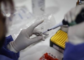 Laboratorios de RD ya están autorizados hacer pruebas de viruela del mono