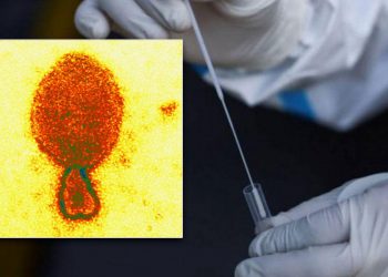 ¡NUEVO VIRUS! Tiene origen animal y ya existen 35 casos en China