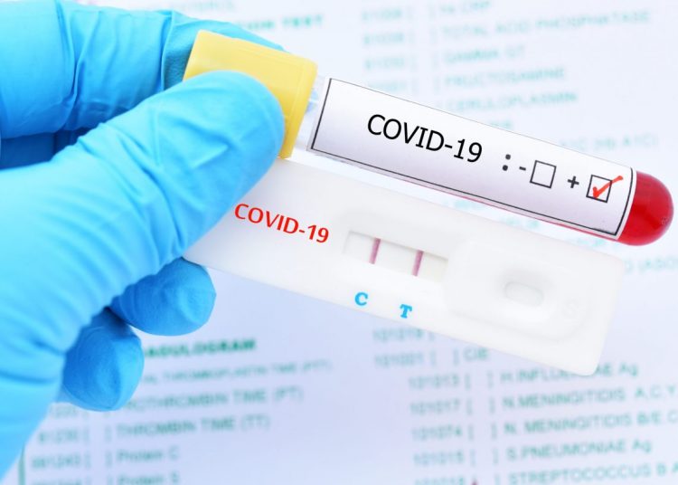 Salud Pública reporta 40 nuevos casos de Covid-19 en el país