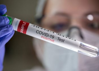 Salud Pública informa sobre 24 nuevos casos de covid-19