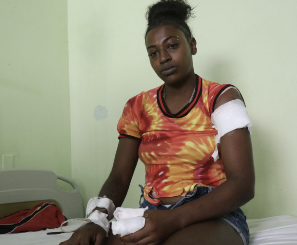 Atroz agresión: mujer pierde dos dedos tras ataque de su expareja