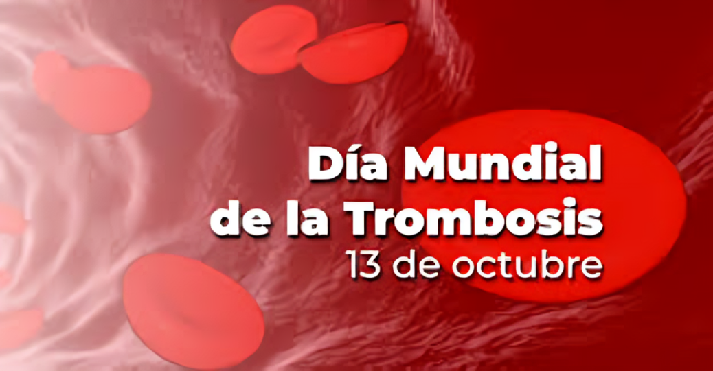 13 de Octubre: Día Mundial de la Trombosis